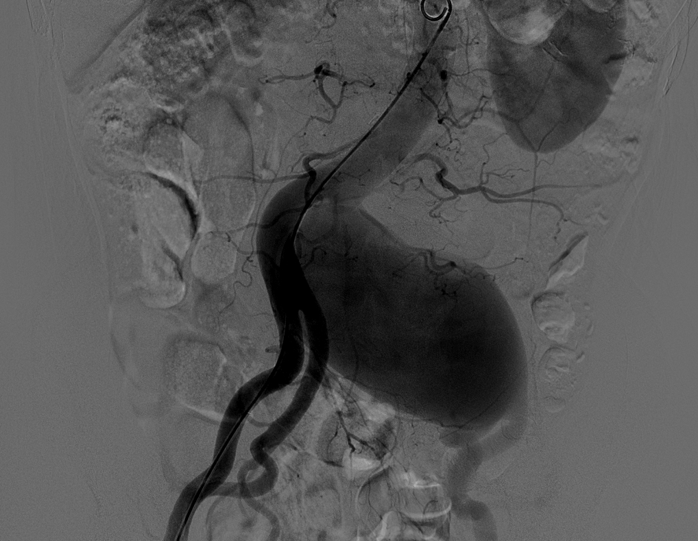 QQ图片20150217132020.png QQ图片20150217132020.png