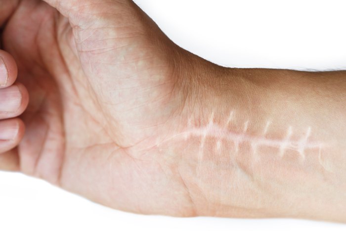 pki410192.jpg pki410192.jpg